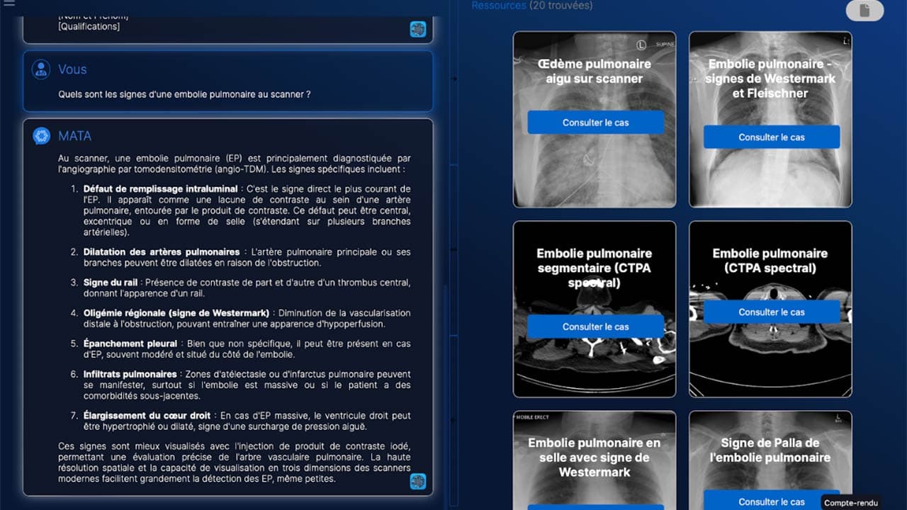 Sophia : la medtech Mata lance son Chatbot IA pour les radiologues